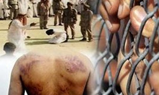 عکس(18+)/ نحوه اعتراف‌گیری در زندان‌های عربستان