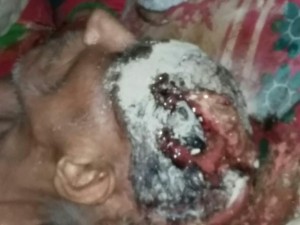 بوی تعفن شدید مانع امداد رسانی اورژانس + تصاویر (18+)