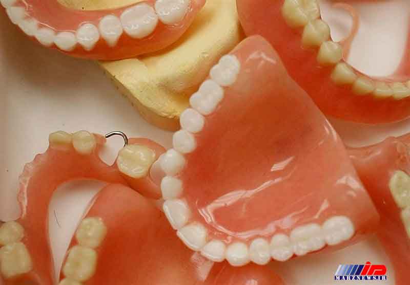 محموله قاچاق دندان مصنوعی کشف شد