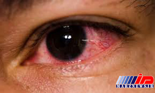 علائم و عوارض مصرف گل در جوانان