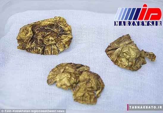 کشف گنجینه طلای ساکاها با قدمت 2800 سال