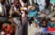 کسب و کار ائتلاف سعودی با مرگ یمنی ها