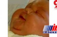 تولد نوزاد ۵ کیلویی در مشگین‌شهر اردبیل