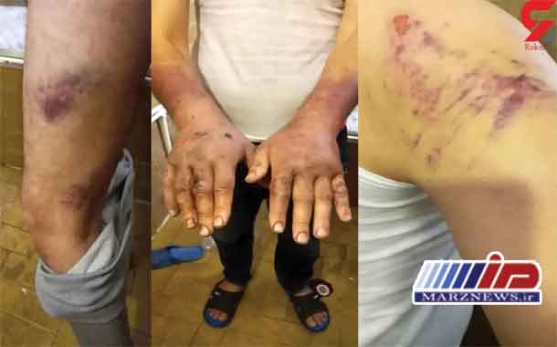 شکنجه پناهجویان افغان به دست مرزبانی ترکیه